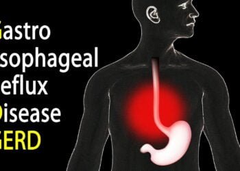 Mengajak Milenial Lebih Kenal GERD-Anxiety 