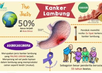 Apa itu Kanker Lambung?