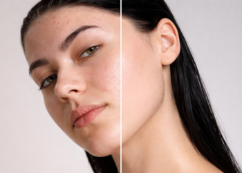 memperbaiki skin barrier