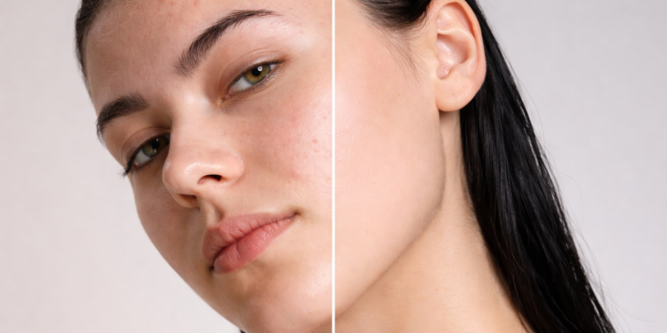 memperbaiki skin barrier memperbaiki skin barrier