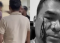 kasus pemukulan bro ron