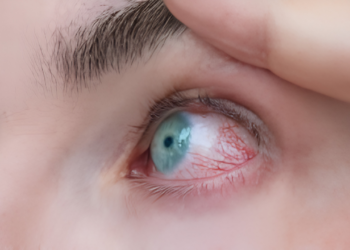 retinopati diabetik